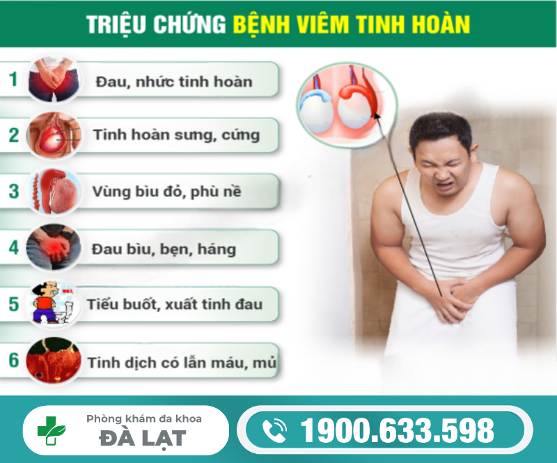 Hình ảnh minh họa